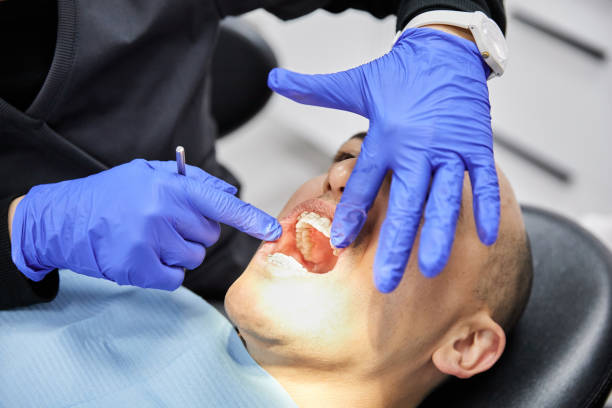 Best Emergency Root Canal Treatment in Chester, IL