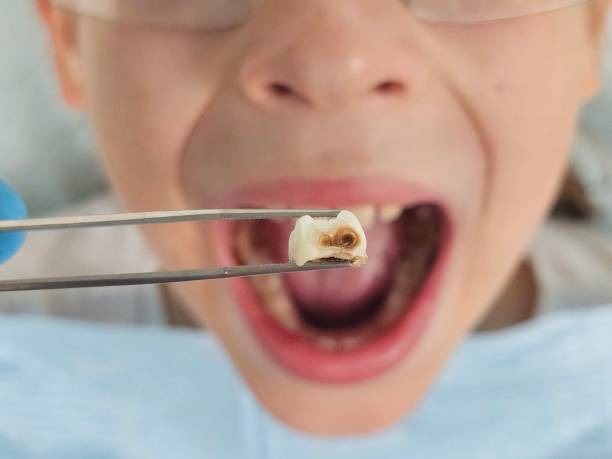 Best Pediatric Emergency Dentist in Chester, IL